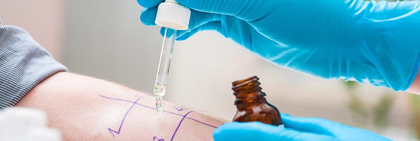 皮膚刺激試驗(yàn)