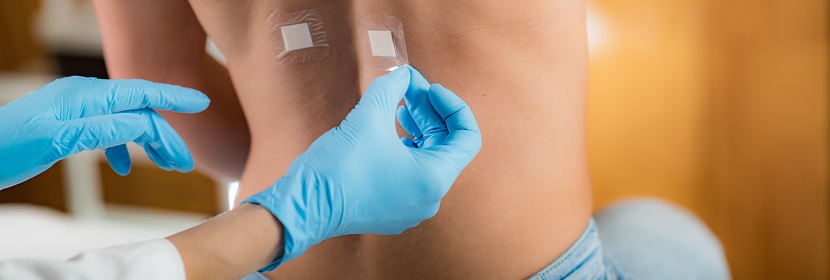 皮膚光變態(tài)反應(yīng)試驗(yàn)