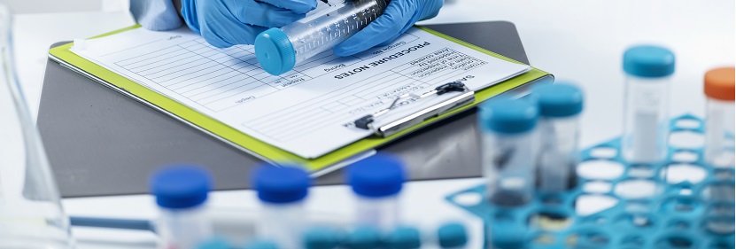 酚醛模塑料用酚醛樹脂檢測