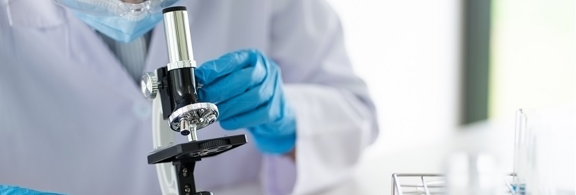 聚氧化乙烯檢測